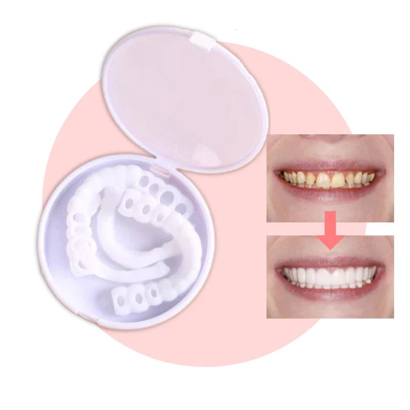 Facettes Dentaires Réutilisables - Sourire Parfait et Confort Optimal