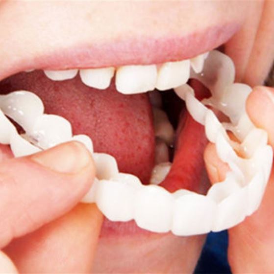 Facettes Dentaires Réutilisables - Sourire Parfait et Confort Optimal