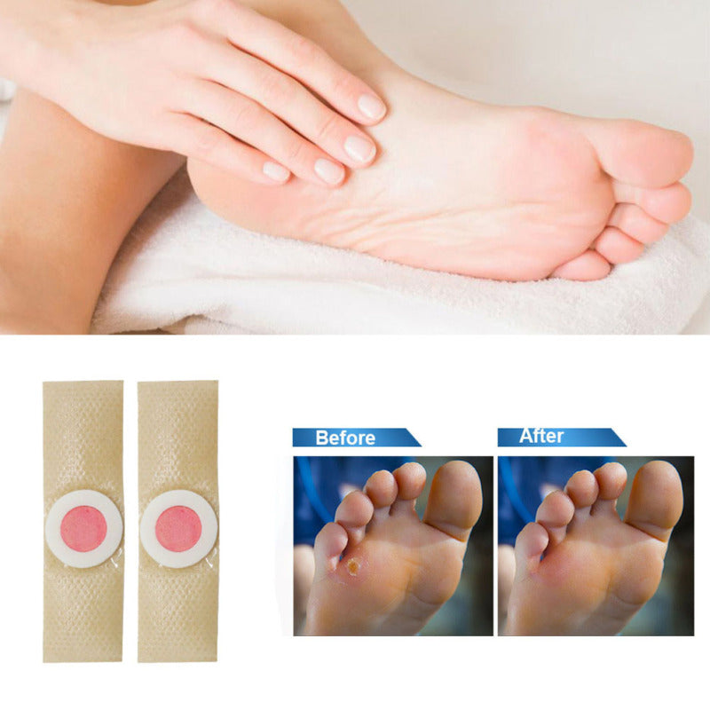 Plaques Anti-Corns pour Soulagement Douleur - Confort et Soutien pour Vos Pieds
