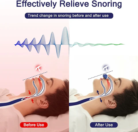 Dispositif Micro CPAP Portable - Sommeil Réparateur en Voyage