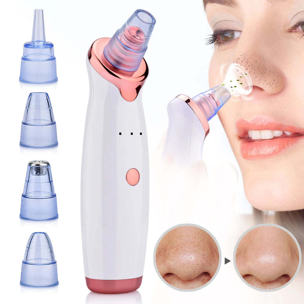 Outil d'aspiration pour Points Noirs - Élimination Douce et Efficace des Impuretés