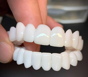 Prothèses Dentaires Sur Mesure - Restaurez Votre Sourire Naturel