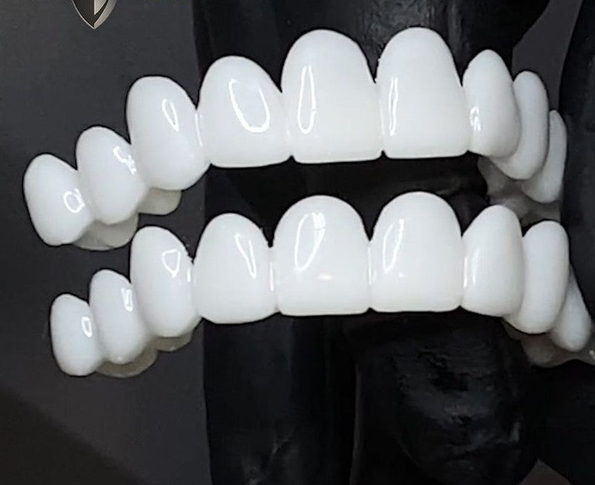 Prothèses Dentaires Sur Mesure - Restaurez Votre Sourire Naturel