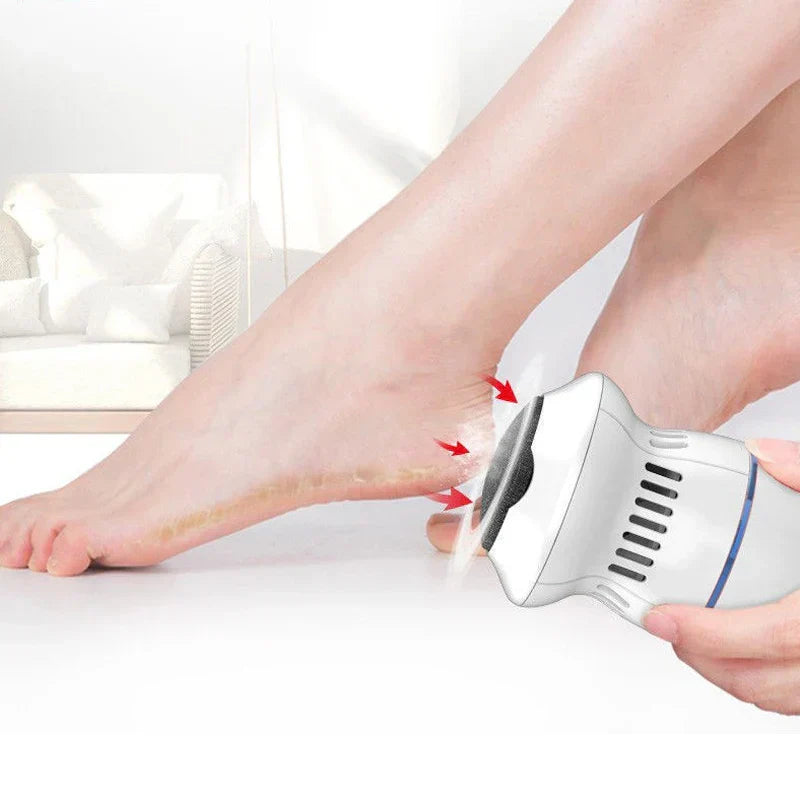 Épilateur Électrique pour Pieds - Élimination Douce des Callosités