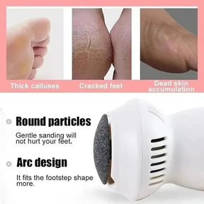 Épilateur Électrique pour Pieds - Élimination Douce des Callosités