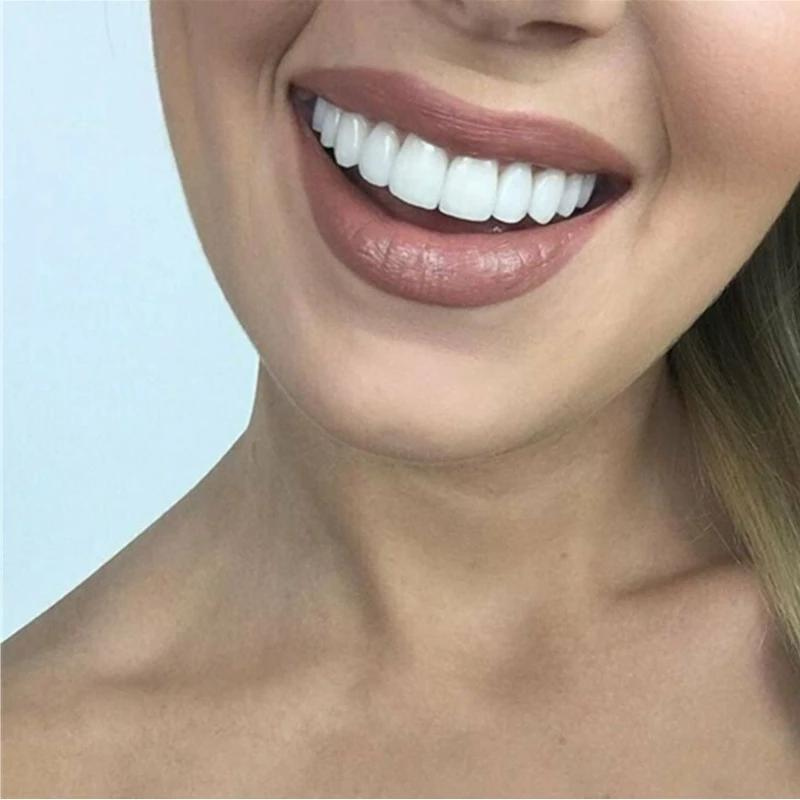 Prothèse Dentaire Facile à Utiliser - Sourire Naturel Instantané et Réutilisable
