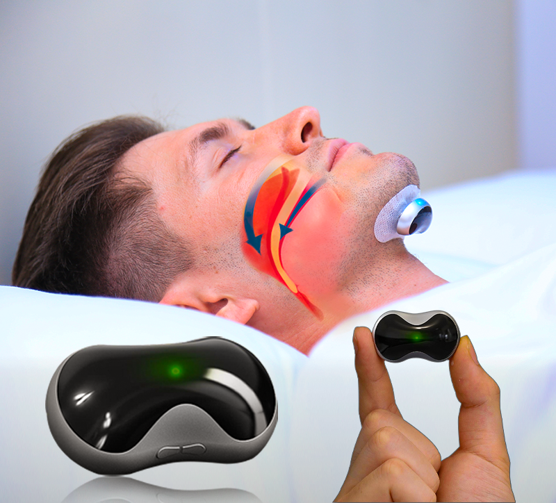 Dispositif Anti-Ronflement Électrostimulation - Améliorez Votre Qualité de Sommeil